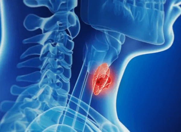 OTORHINOLARYNGOLOGY (ENT)